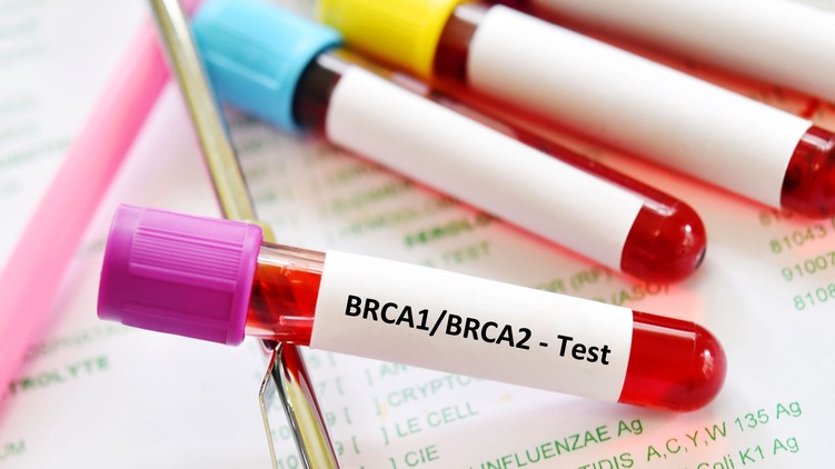 vérvétel BRCA teszt vizsgálat mellrák petefészekrák