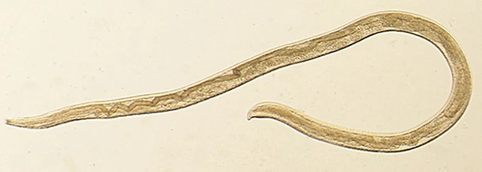Parazit Thelazia gulosa prvi put otkriven u oku čoveka