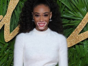 Winnie Harlow a tél királynője ebben a ruhában!
