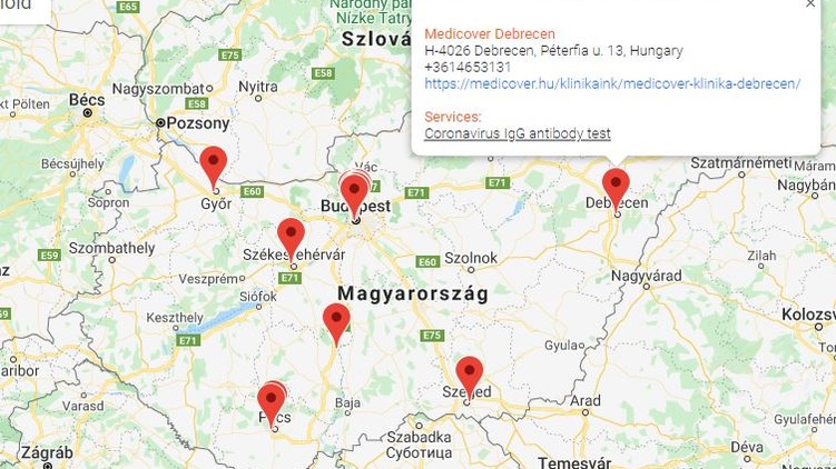 covid-19, koronavírus, koronavírus teszt