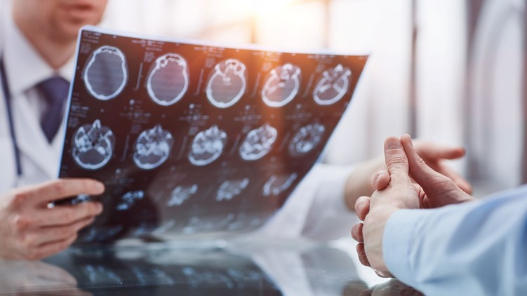 daganatos betegségek agydaganat rák jele