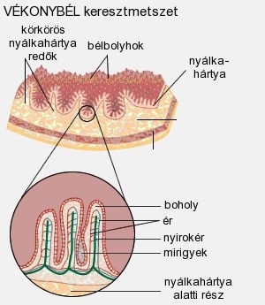 Crohn-betegség