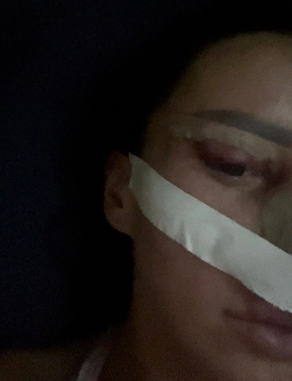 Slađa Poršelina nakon operacije