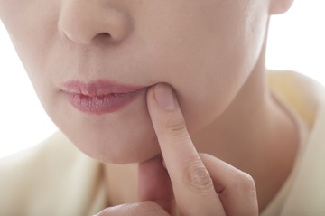 cink hiány berepedezett szájzug szájszeglet tünete