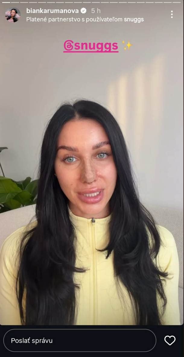 Bianka Rumanová ukázala zmenený nos, už si ho iba prelepuje.
