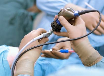 Mitől függ, hogy mennyire fáj a gyomortükrözés? című cikk nyitóképe