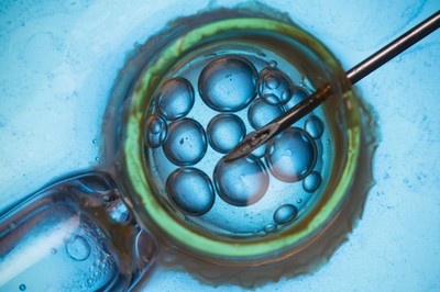 Czy mąż może zablokować przeniesienie zarodka do organizmu kobiety?