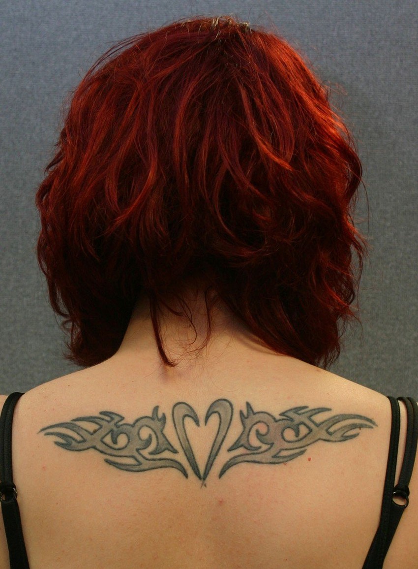 Jedan od 100 slučajeva - tetovaža na leđima žene uzrokovala je upalu limfnih čvorova (foto: ilustracija)