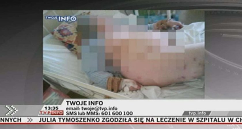 Zdjęcia zrobiła córka innej pacjentki na tej sali