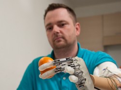 Niesamowity wynalazek. Sztuczna ręka czuje przedmioty. WIDEO