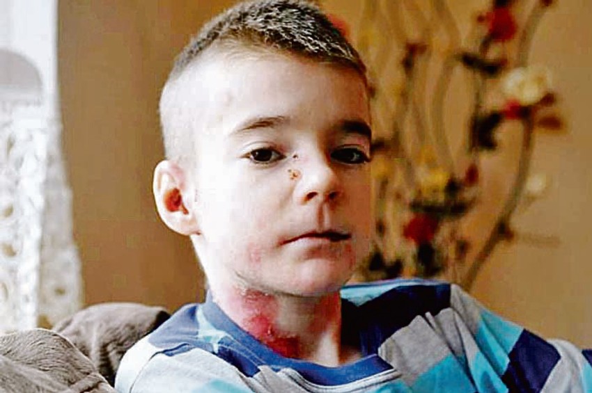 Despot Lazić, dečak-leptir, preminuo je  usled komplikacija sa srcem