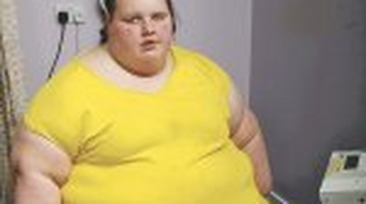 17 évesen 260 kiló a lány