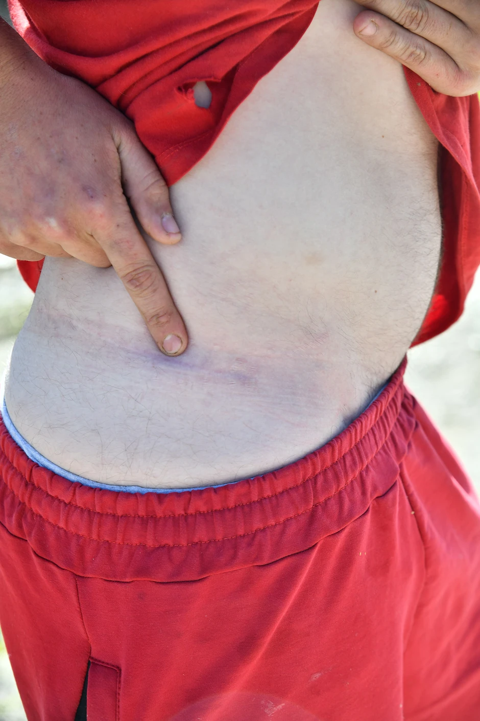 Nikola Mitrović: Rana od metka