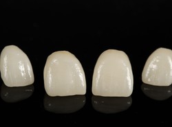 Dlaczego praczłowiek rzadko miał próchnicę?