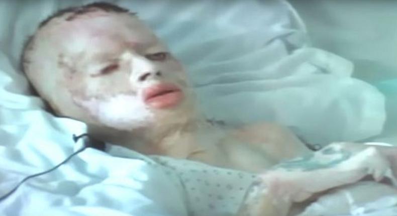 8-yr-old Robbie Middleton in a hospital bed after his attack