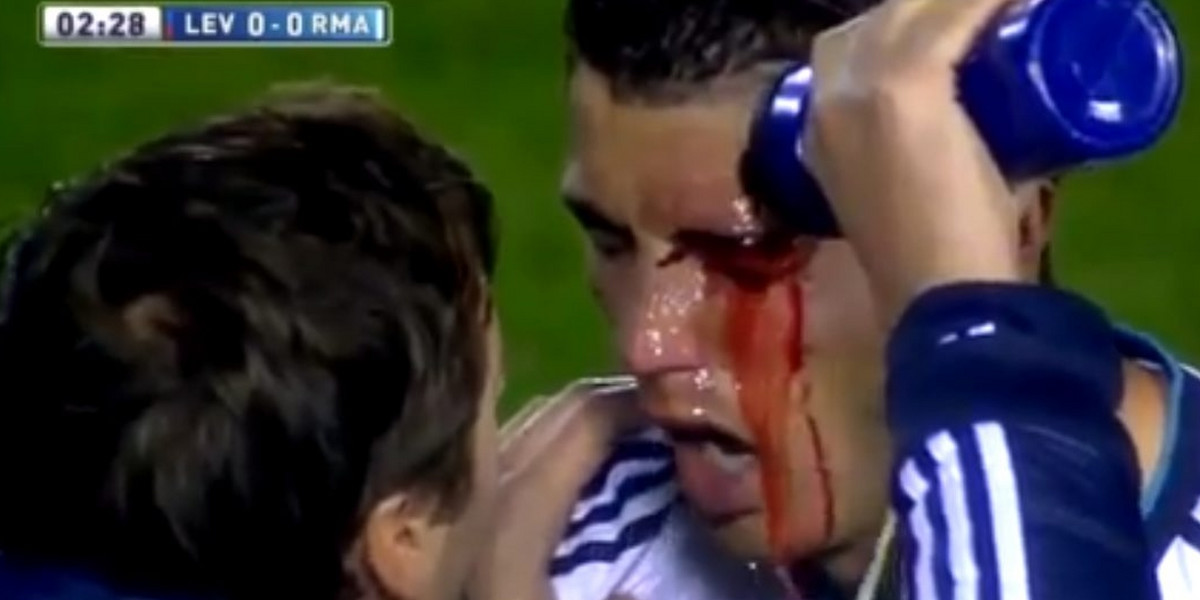 Krwawiące oko Ronaldo