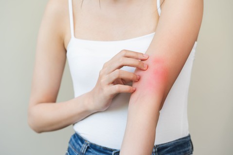 Gyermekek tízezreit érinti Magyarországon – így rontja az életminőséget az atópiás dermatitisz