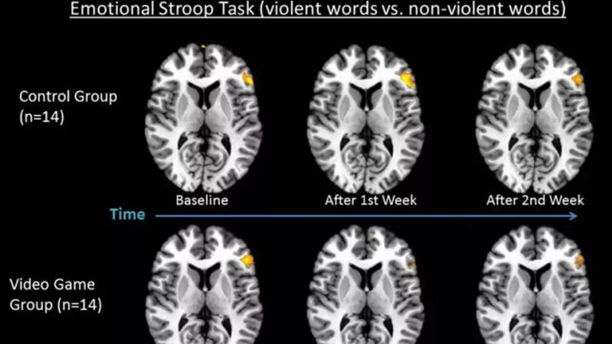 Brutalne gry wideo wywierają negatywny wpływ na funkcjonowanie mózgu