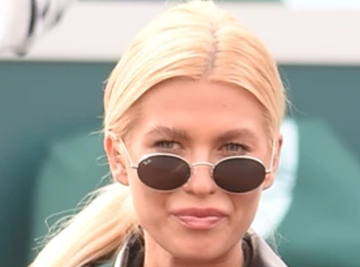 "OPADALA MI JE KOSA OD STRESA!" Noletova snajka je otkrila dugo čuvanu tajnu