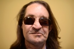 Mężczyzna po przeszczepie twarzy. Niesamowity efekt leczenia. ZDJĘCIA