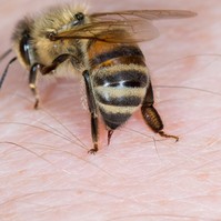 1 hete kómában fekszik a magyar zenész - darázscsípéssel került kórházba