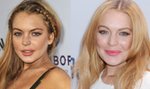 Lindsay Lohan usuwa piegi!