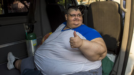 Életmentő műtétet hajtanak végre a világ legkövérebb férfiján - fotók