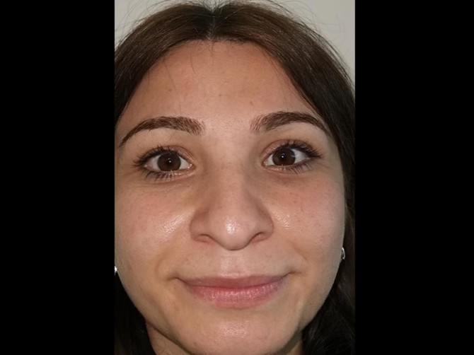 Fotografije žene pre i posle operacija izazvale su lavinu komentara