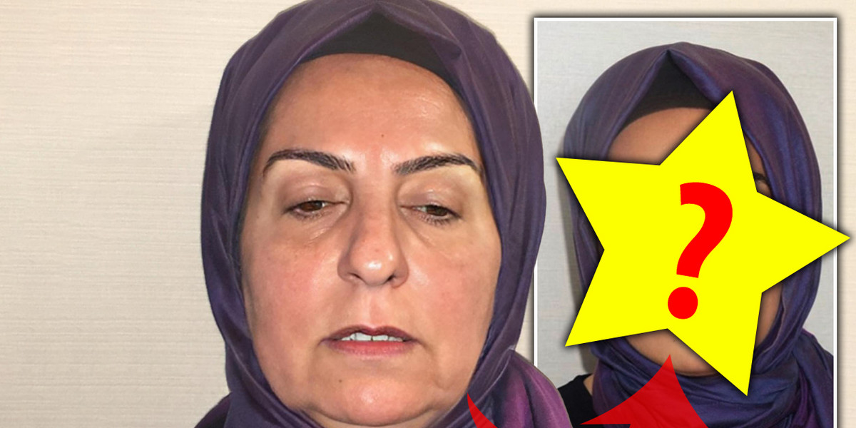 Niewiarygodna metamorfoza 68-letniej kobiety w Turcji. Czy to wydarzyło się naprawdę?