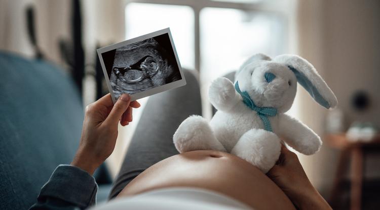 Most jelentette be a csodás hírt a TV2 sztárja Fotó: Getty Images