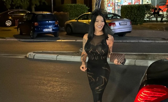 Milena Kačavenda sa veštačkom zadnjicom