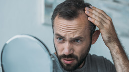 Komórki macierzyste przyczyną łysienia mężczyzn. Nowe badania 