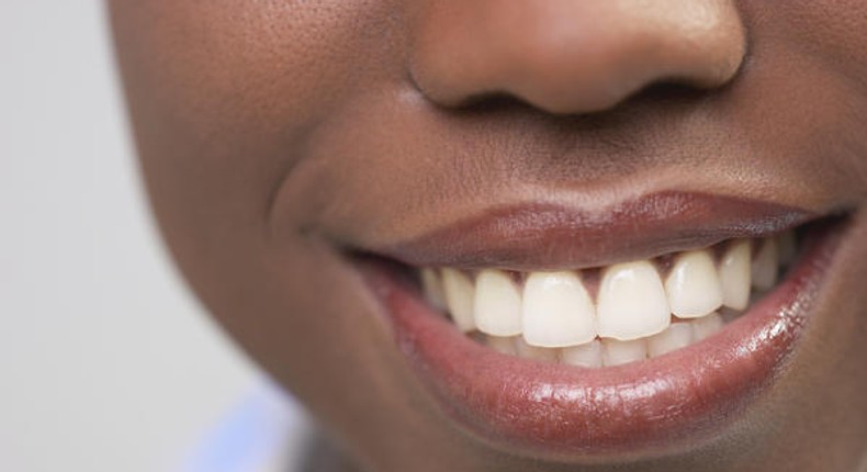 5 natural ways to make your teeth white and shiny