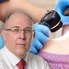 Svaka promena na koži može da se ukloni iz medicinskih ili estetskih razloga