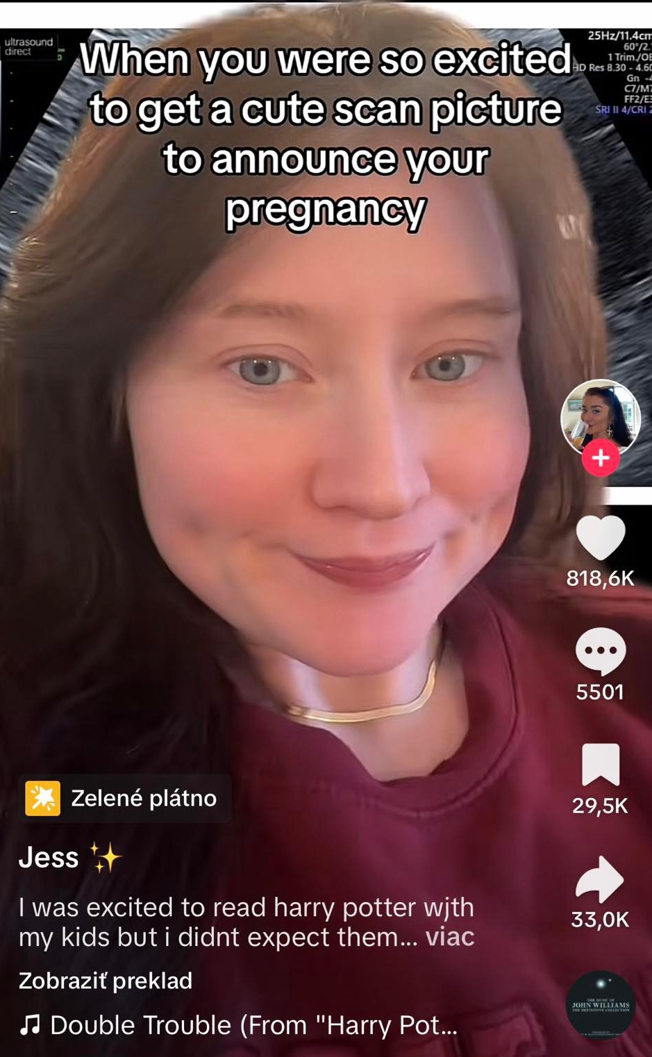 Žena ostala zhrozená z fotografie ultrazvuku.