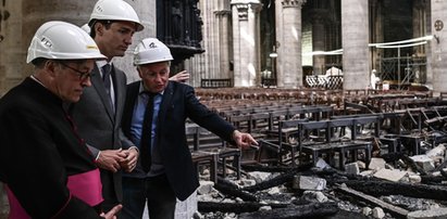 Groźne zjawisko po pożarze katedry Notre-Dame. Wykryli to we krwi dziecka