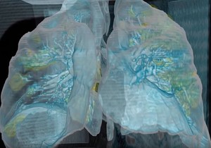 pluća, korona virus