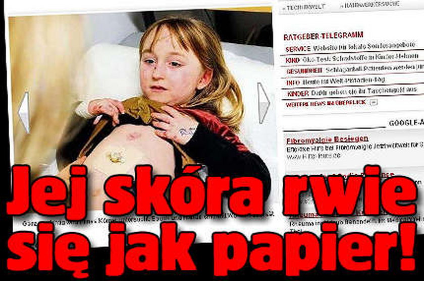 Jej skóra rwie się jak papier