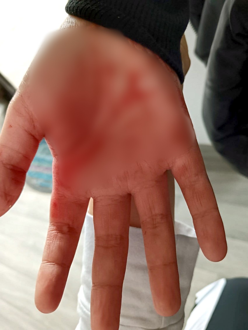 V.S, učenik iz Vlasotinca, vršnjačko nasilje