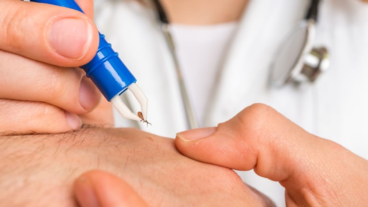 Lyme-kór kullancs kullancscsípés tünetei lappangás jelei