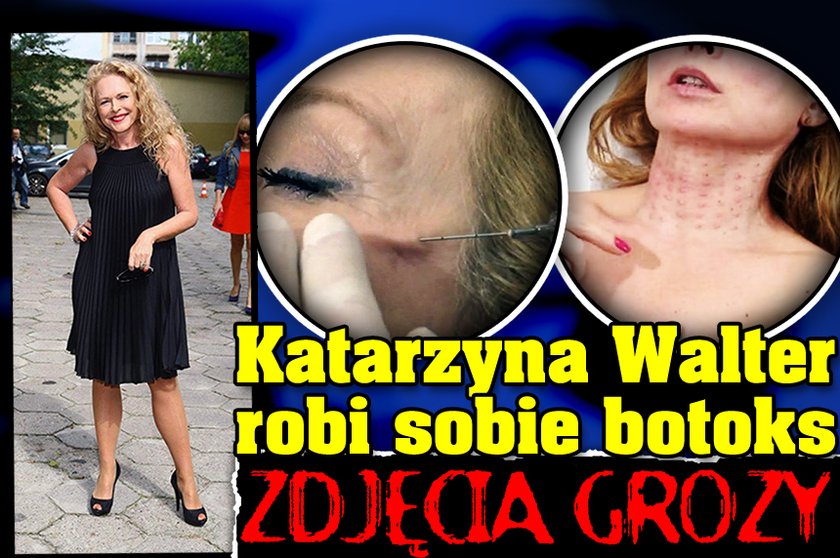 Katarzyna Walter: Robię sobie botoks. ZDJĘCIA GROZY