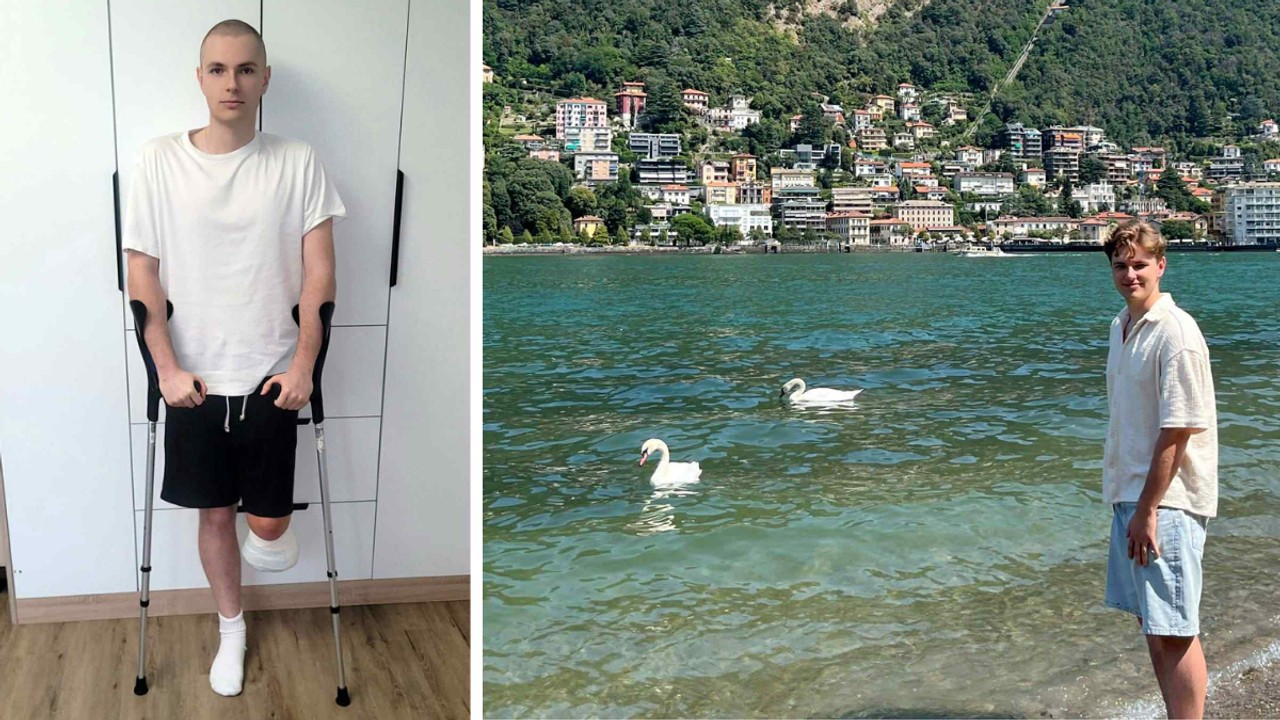 Bartek walczy o powrót do sprawności po amputacji nogi. Trwa zbiórka