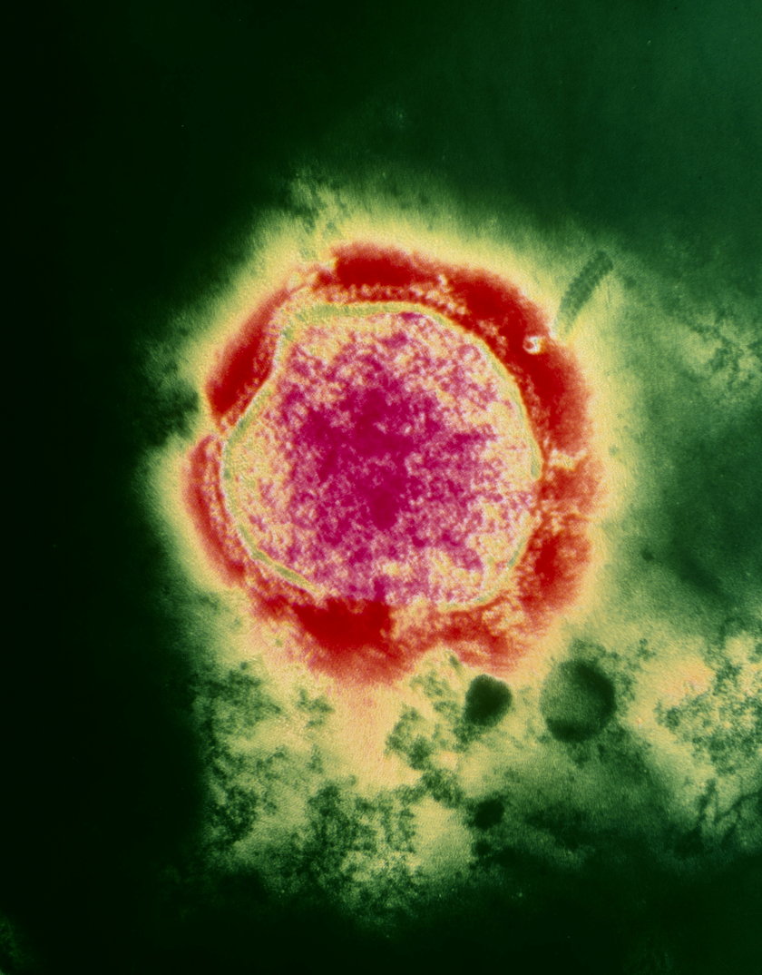 Wirus odry