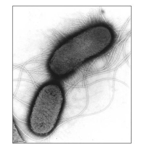 Bakteria E.coli