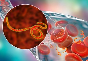 Ebola je vrsta virusne hemoragične groznice