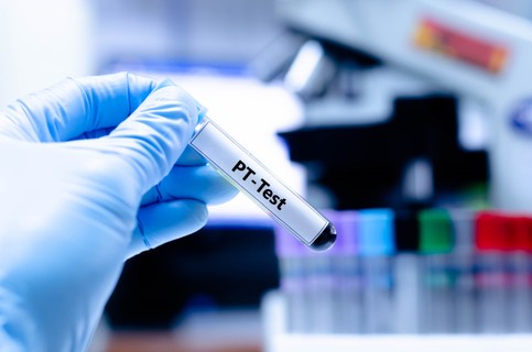 Mit jelent a protombin idő (PT) érték a laborleleten?