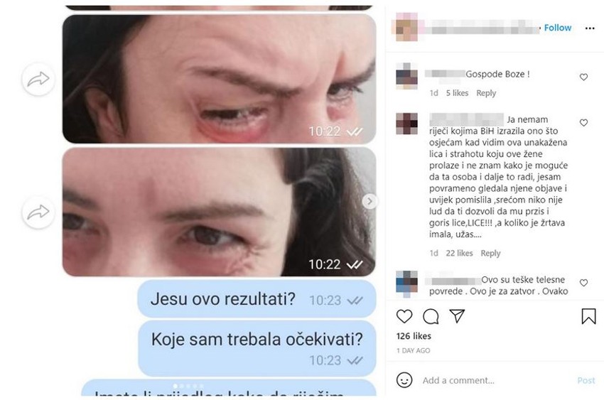 Fotografije žena unakaženih nakon tretmana u Markanovićkinom salonu kruže društvenim mrežama