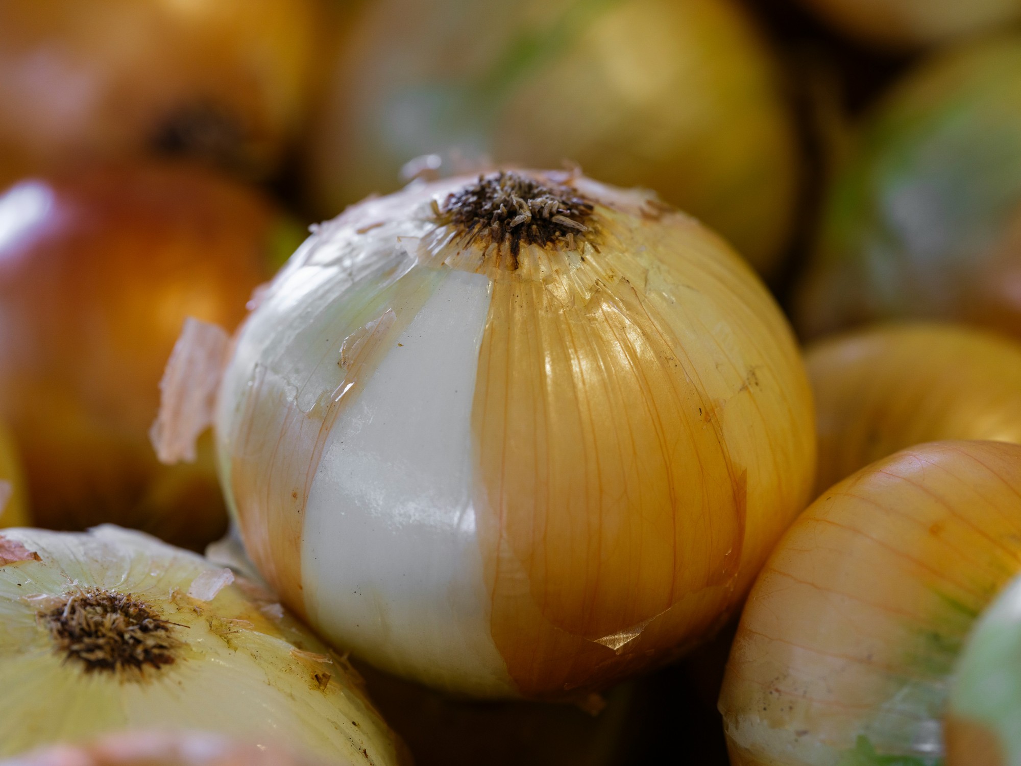 Kašeľ vyčerpáva telo aj dych, no riešenie máte často priamo v kuchyni.