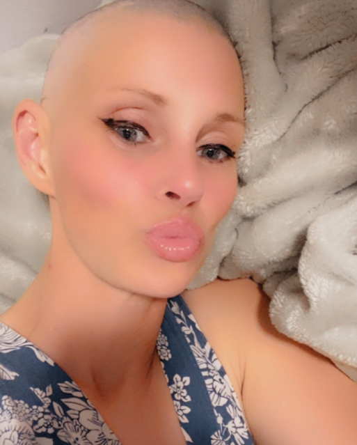 Lekári spočiatku nedávali Nancy veľké šance na prežitie.