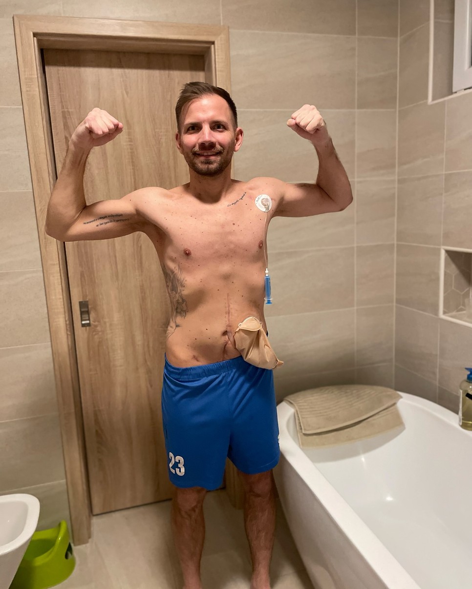 2022 tele, az első műtét utáni időszak, amikor Borsi Dávid igyekezett minél több időt tölteni a családjával, miközben barátkozott a sztómazsákkal is